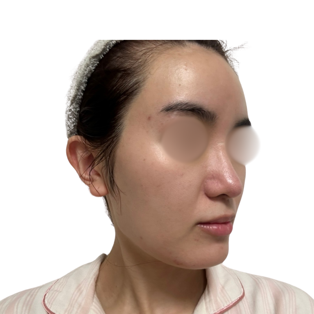 バイオリピール（ミラノリピール）